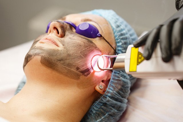 How Laser Technology is Changing the Face of Anti-Aging